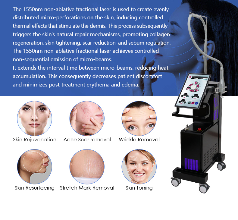 Vetro erbio da 1550 nm&nbsp; Laser&nbsp;